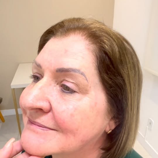 Paciente da NURA após tratamento facial